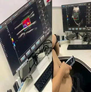 colour-doppler-ultrasound-scan-studio-set.jpg