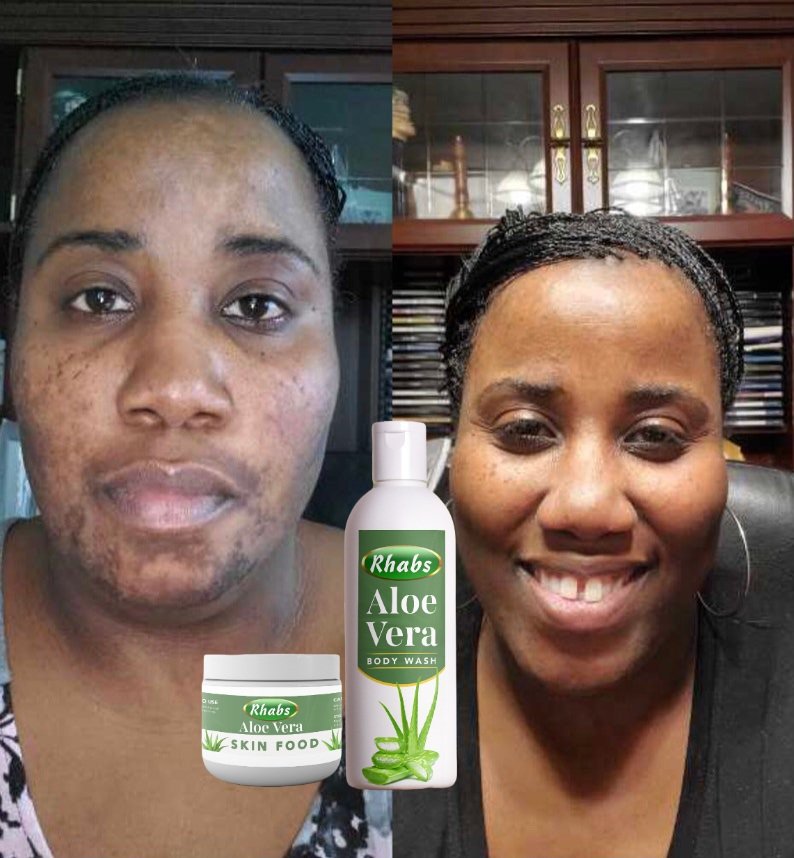 Rhabs Aloe Vera Skin Repair Set in GH