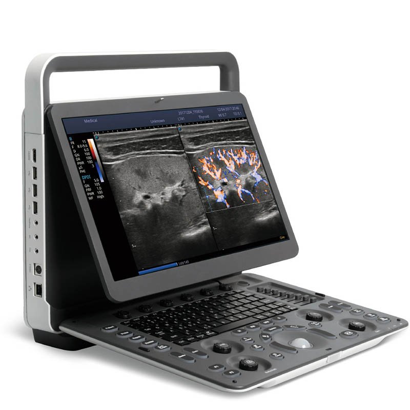 Sonoscape E1 High quality medical portable ultrasound medical scanner in GH