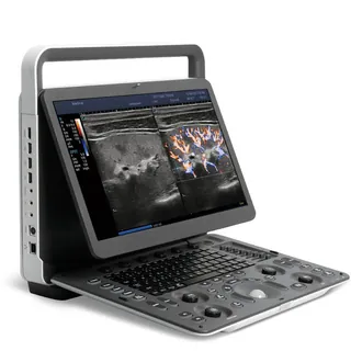 sonoscape-e1-high-quality-medical-portable-ultrasound-medical-scanner.jpg