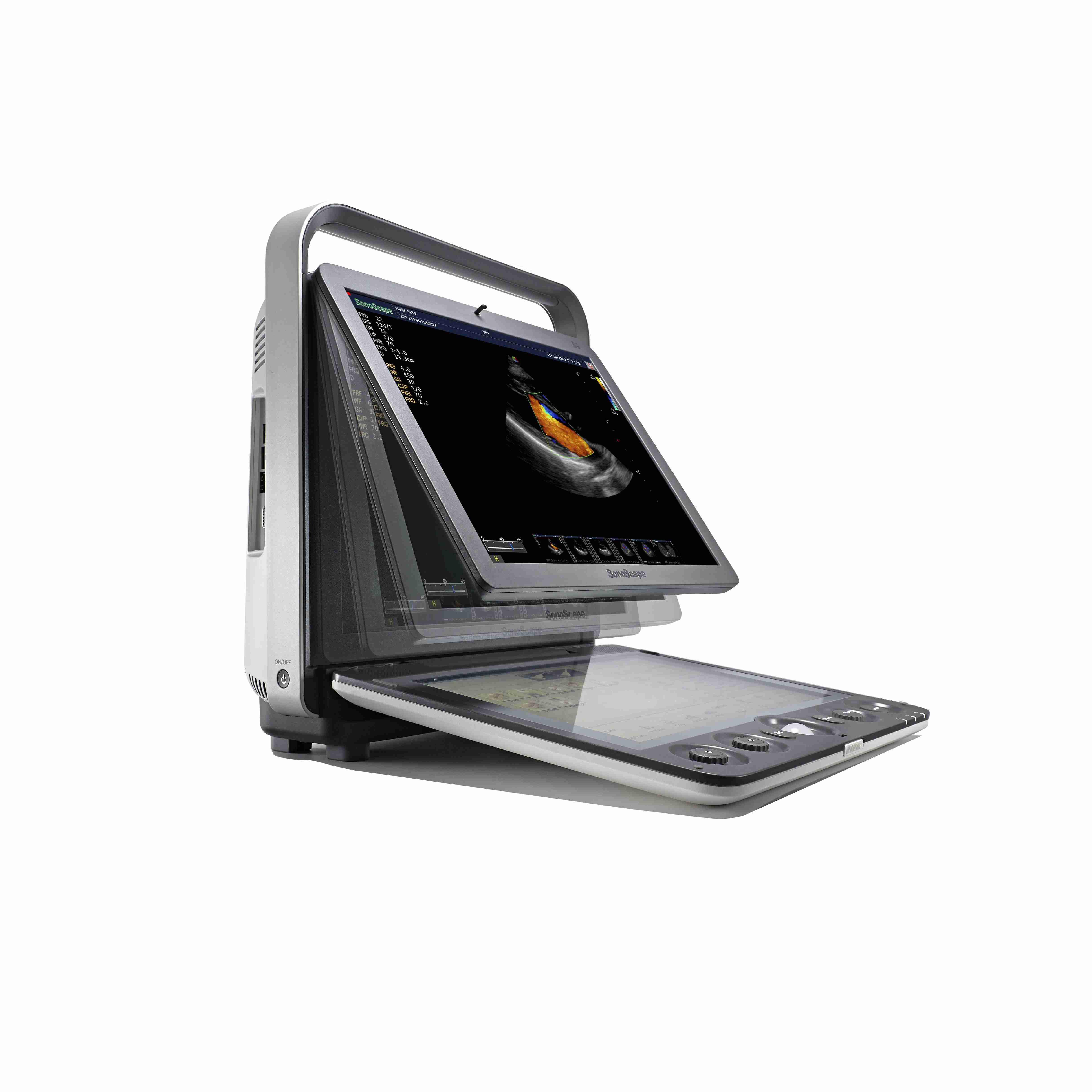 Sonoscape S9 Ultrasound Machine 4D Color Doppler System in GH
